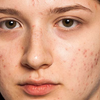 The Natural Fix For Scars