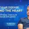 Article image for: When your legs speak before your <i class="tbold">heart</i>: Understanding vascular disease beyond chest pain