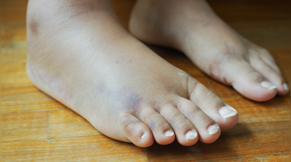 The simplest prevention methods are still the most powerful