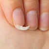 Article image for: So, why do nails become weak in the first place?