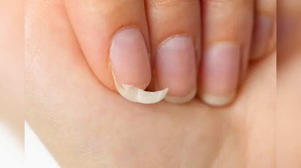 So, why do nails become weak in the first place?