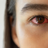 Uncorrected refractive errors