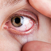 Impact of reduced vision on daily life