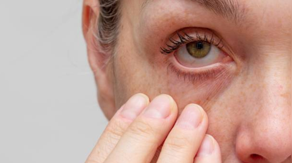 Eye diseases do not have visible symptoms