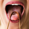 A bluish or purple tongue deserves attention