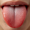 A bright red tongue can point towards deficiencies