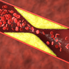 The cholesterol question