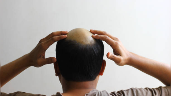 Biotin