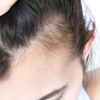 Collagen