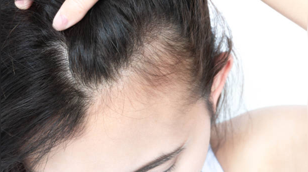 Collagen