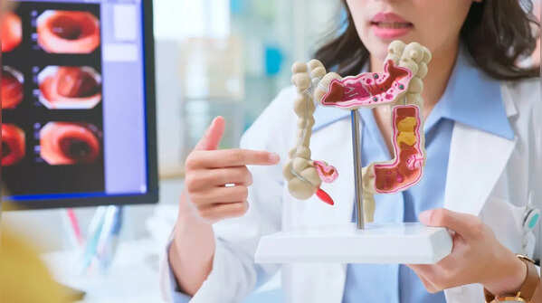 Colon cancer: 4 early warning signs you should not ignore, according to a Harvard doctor