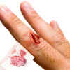 Slow wound healing