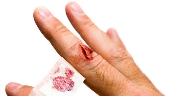 Slow wound healing