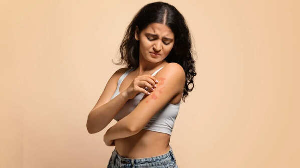 Fabrics that can irritate your skin in summer