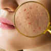 What research says about fabric and skin health