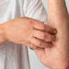 Syphilis: What about it?
