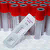 Managing gonorrhea and syphilis