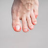 Article image for: Gait problems during the day
