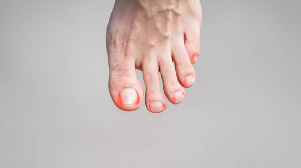 Gait problems during the day