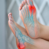 Bunions