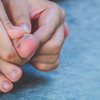 Plantar Fasciitis