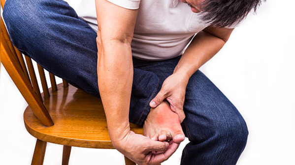 Gout