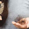Article image for: 5 common reasons for hair thinning