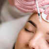 What’s a Botox treatment?