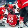 Article image for: Edmonton Oilers defenseman Evan Bouchard faces setback as injury ends World Championship campaign during important NHL offseason period