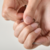 When nails lose their natural colour