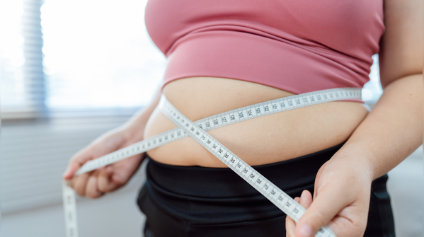 Myth 1: Obesity Is a lifestyle choice