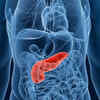Is this the ultimate cure for pancreatic cancer?