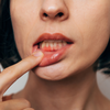 The connection between bleeding gums and bigger health problems