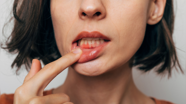 The connection between bleeding gums and bigger health problems