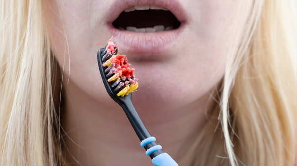 Your diet may be affecting your gums more than you realise