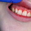 Small daily habits that keep gums healthy