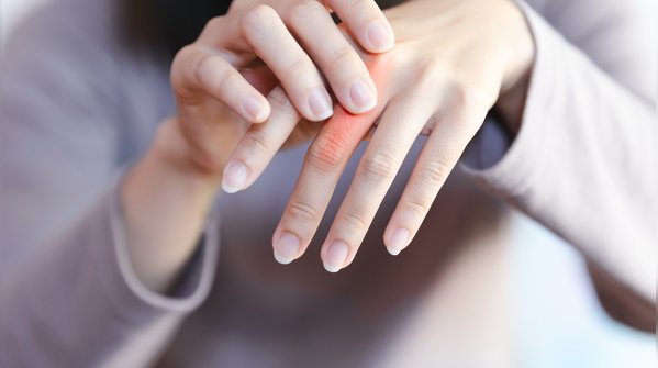 What is Rheumatology: More than just joint pain