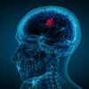 Can brain tumors be prevented?