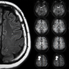 When should a headache raise concern?