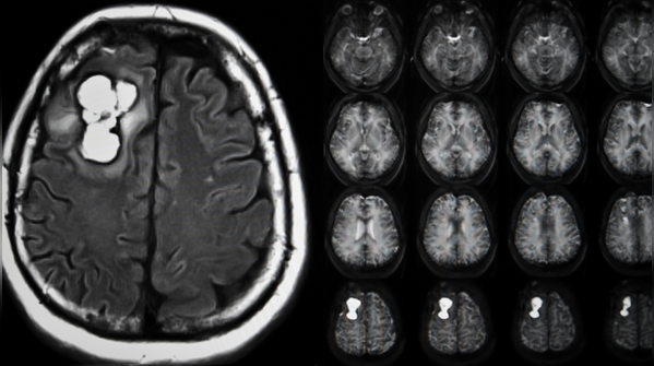 When should a headache raise concern?