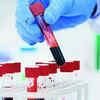 Article image for: Blood test can predict lung cancer 5 years before diagnosis