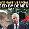 Article image for: Andrew Windsor's Facial Injury Sparks Dementia Speculation After <i class="tbold">insider</i>s Sound Alarm