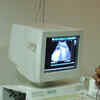 Article image for: Ban apps aiding in detection of sex of fetus: Civil surgeon writes to state govt