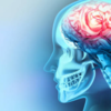 Why a stroke can leave one side of the body weak, and what helps ...