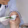 10 cosmetic procedures to look younger