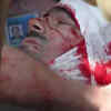 Article image for: <i class="tbold">russian journalist</i> hurt in eastern Ukraine