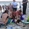 Article image for: Shark attacks injure two teens in <i class="tbold">north carolina</i>