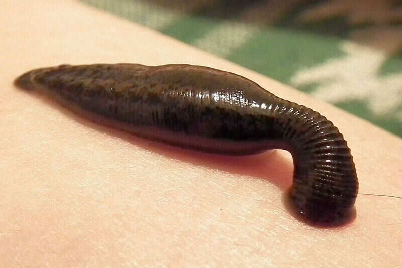 leech-sucking