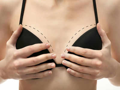 Important Factors and Myths Associated to Sagging Breasts