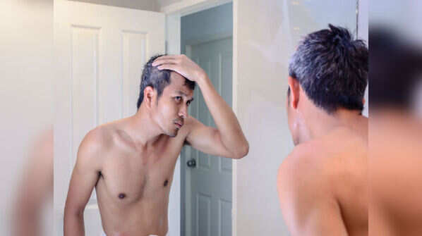 Male pattern baldness